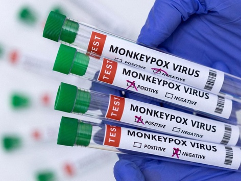 Monkeypox is already in Poland: what is known